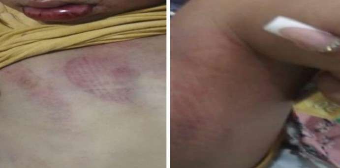 VEJA VÍDEO - Homem é preso após filhos de 1 e 4 anos serem encontrados feridos dentro de casa em Nova Granada